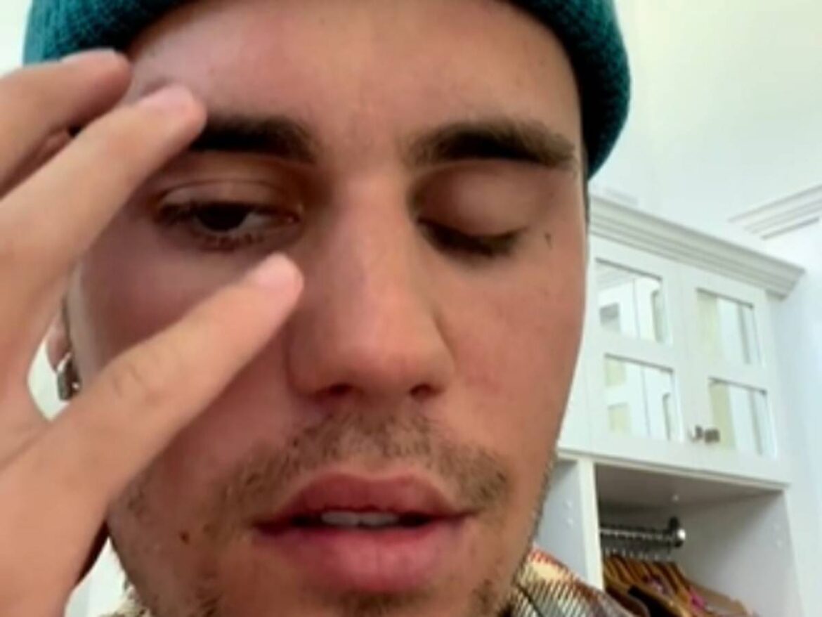 Oh Baby Justin Bieber Reanudar Su Gira Tras Par Lisis Facial El